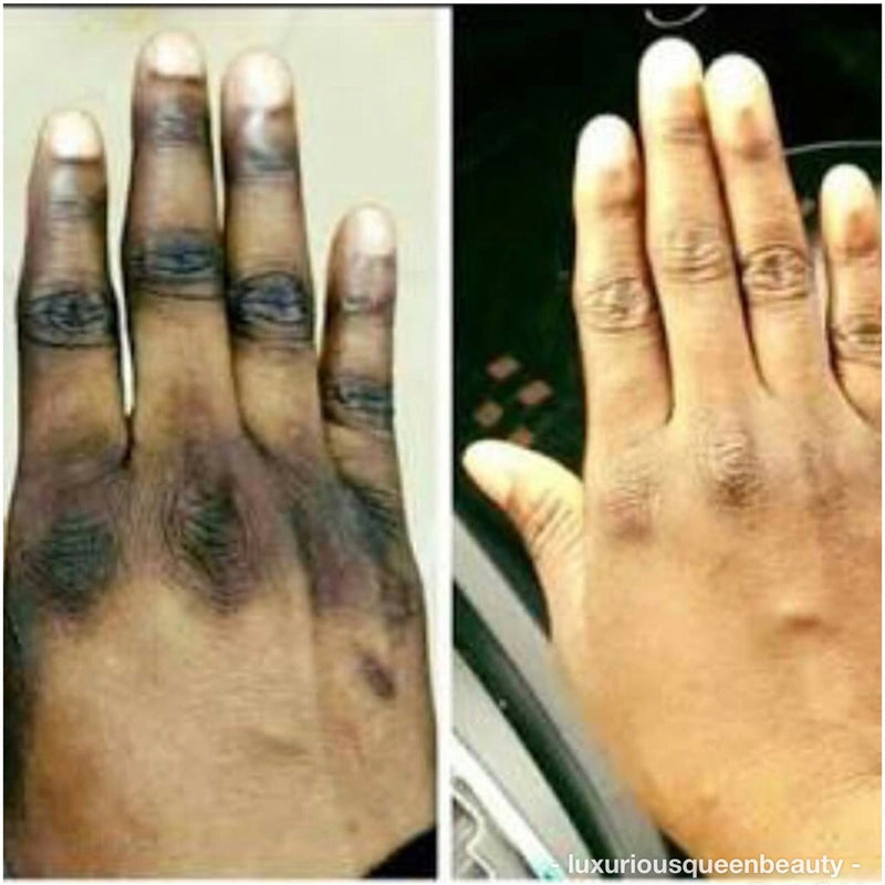 Creams for stubborn areas