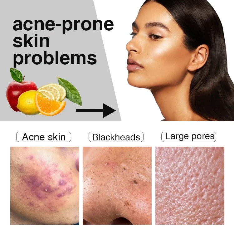 Salicylic Serum+Cream Duo