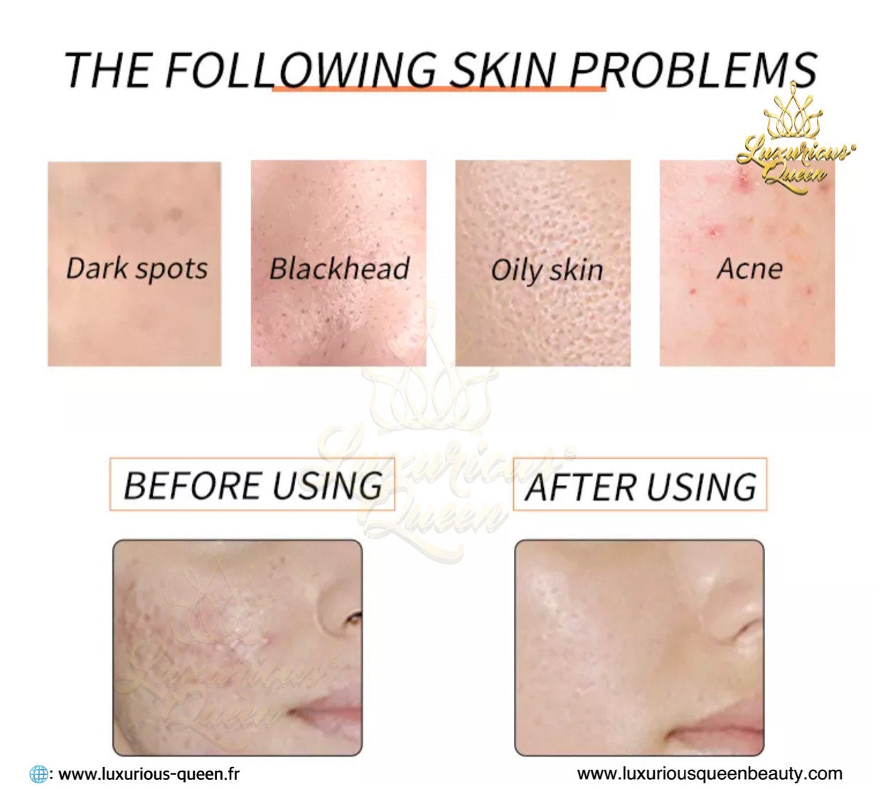 PAPAYA SOAP KOJIC ACID GLUTATHIONE 24k Gold