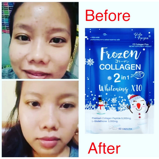 Frozen Collagen 10x éclaircissant