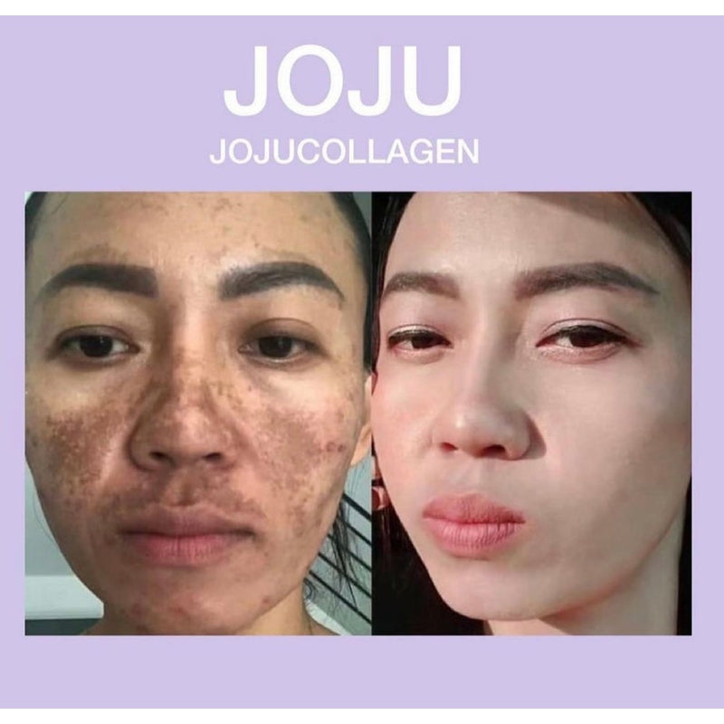 JOJU COLLAGEN 1000 mg ACNE, DARK SPOTS, MELASMA